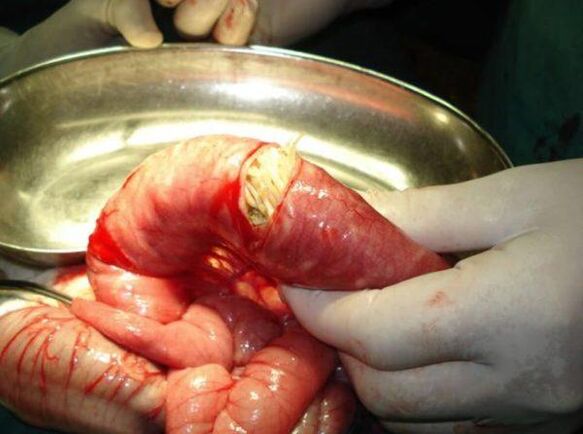 than the worms are dangerous