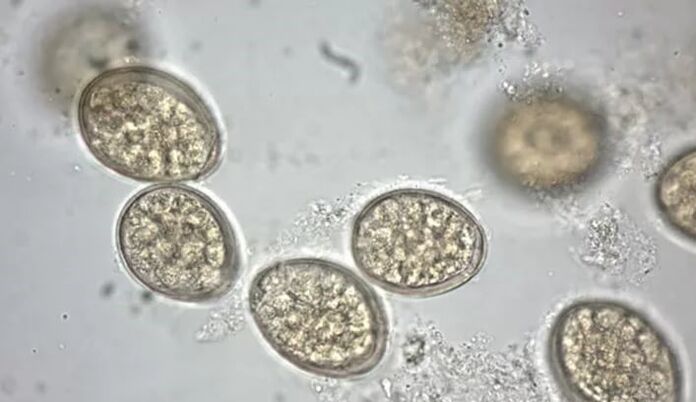 parasites under a microscope