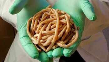 Methods of elimination of parasites from the body